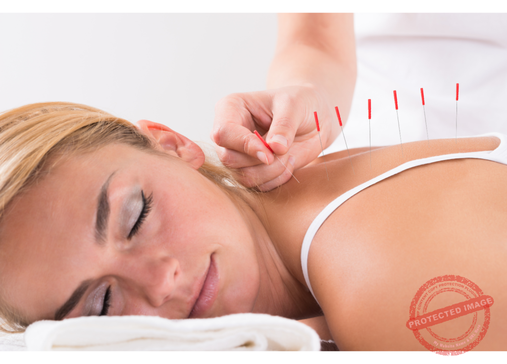 Acupuncture Schools Online - At least 3,000 old practice-1